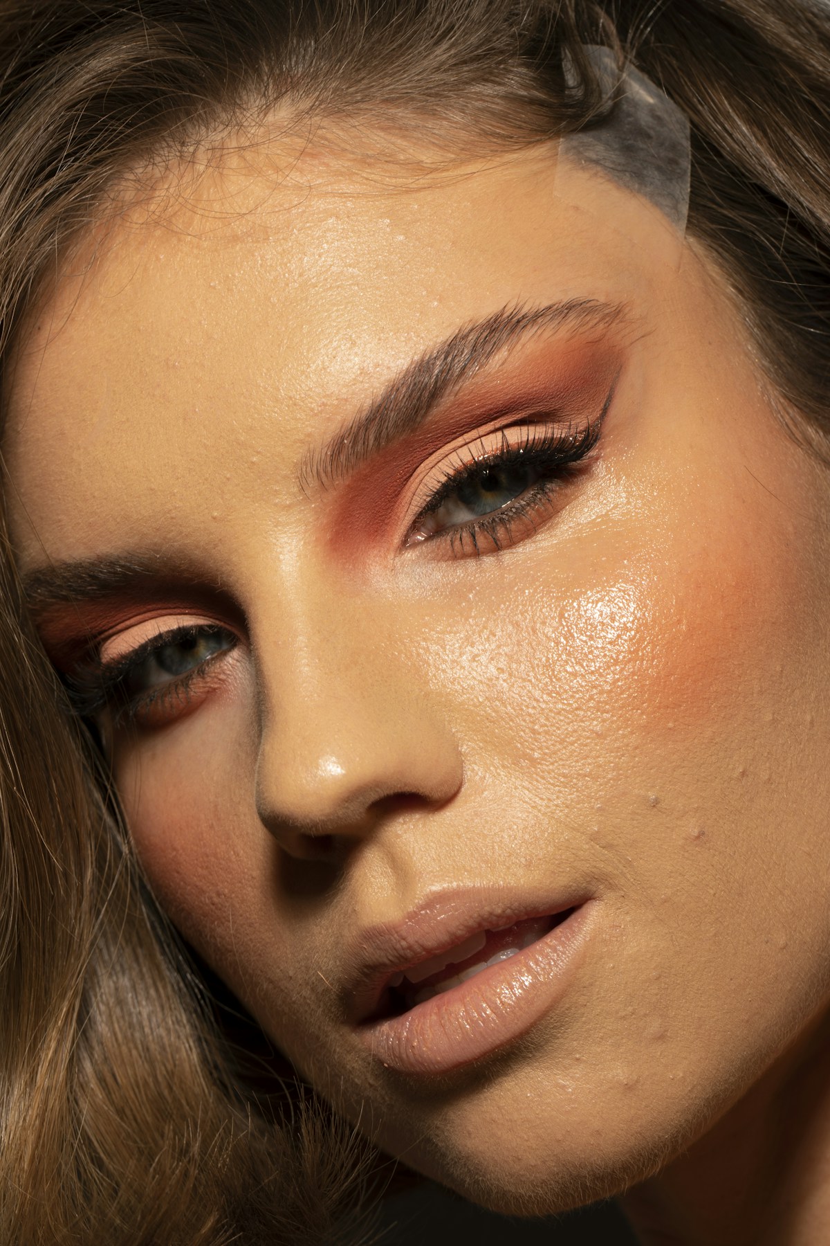 Pigmentation removal Bolton