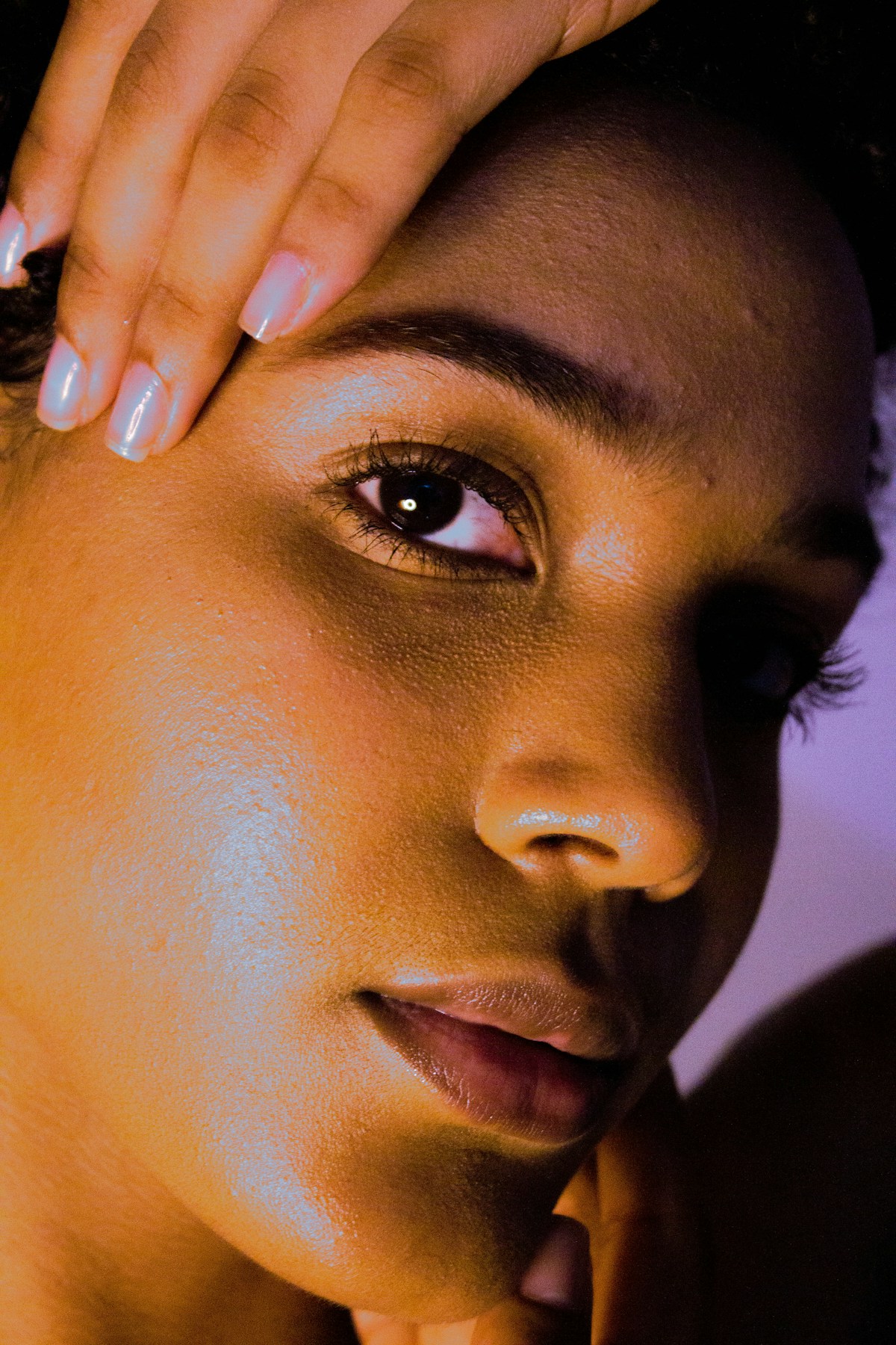 Thread vein removal Bolton