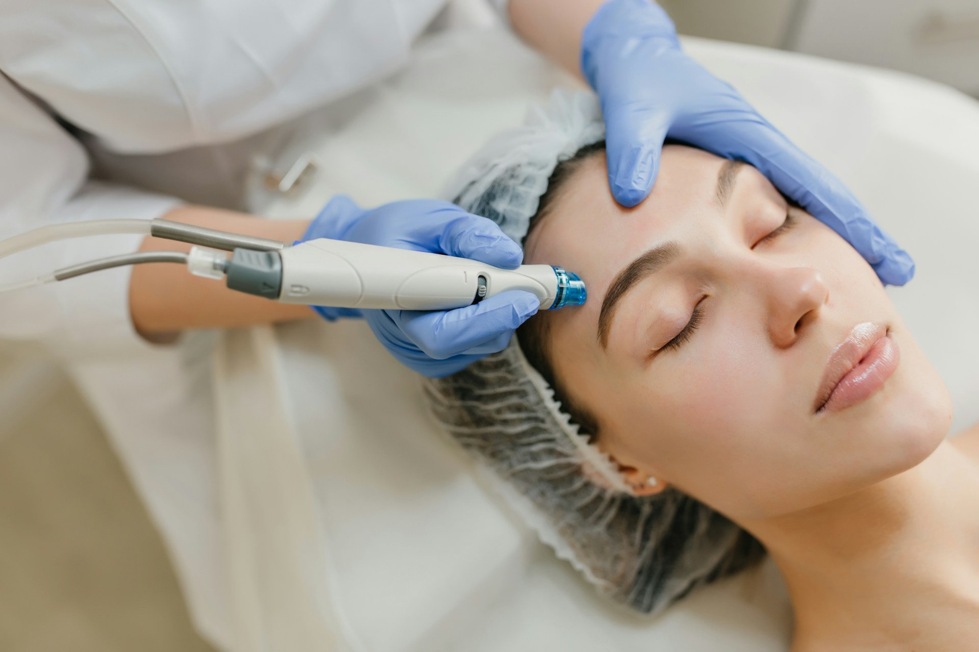 Laser skin rejuvenation Bolton